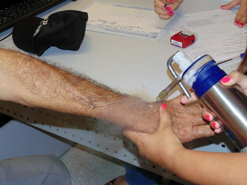 Mutirão oferece atendimentos dermatológicos à população — Foto: Hospital Regional/Divulgação