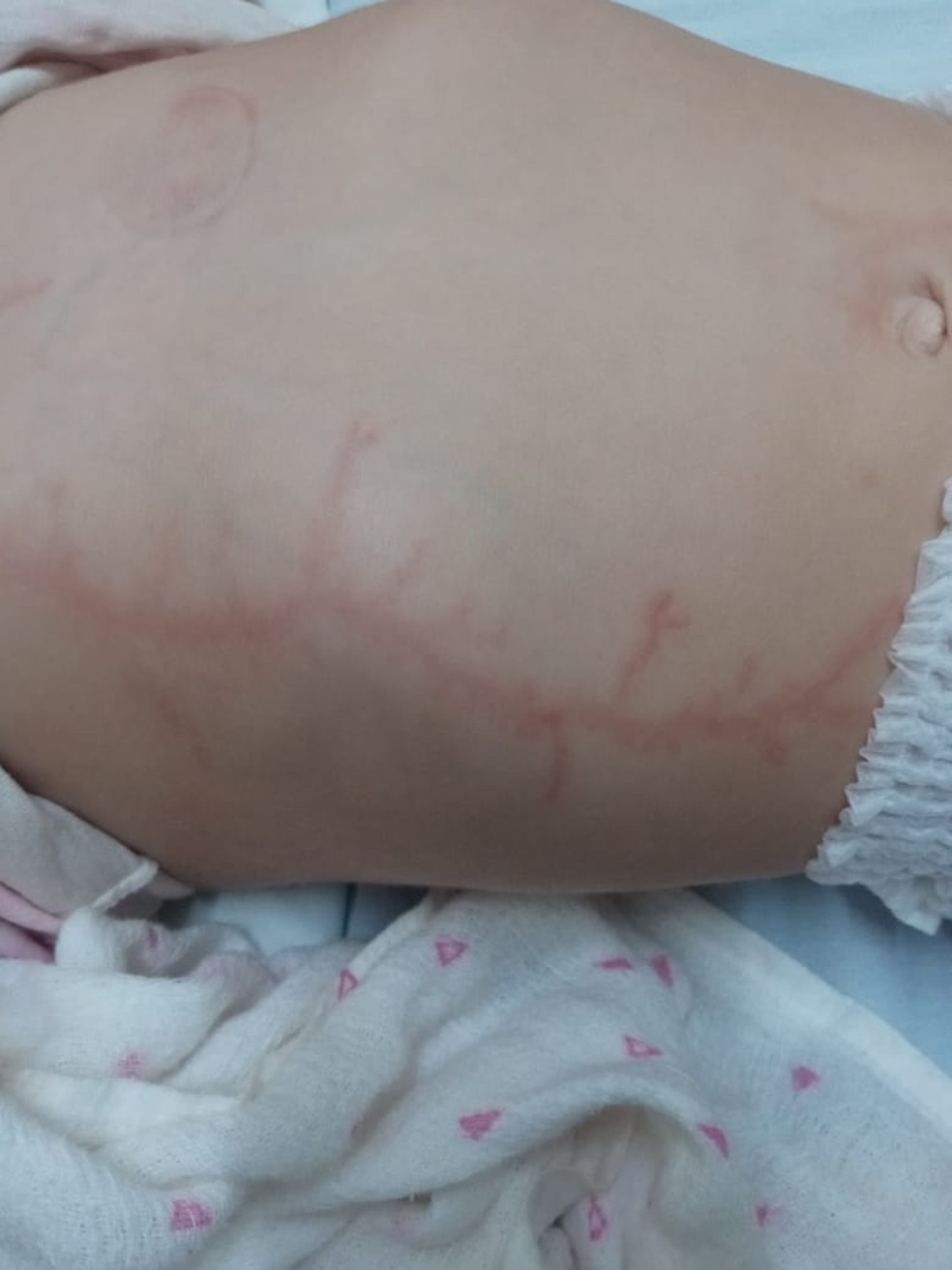 Pai, filho e sobrinha de 1 ano ficam feridos após queda de raio no interior do RN — Foto: Cedida