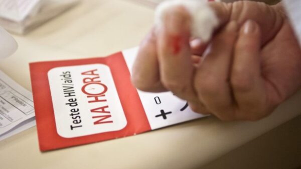 Teste de HIV/aids