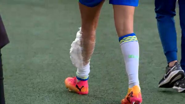 Antonia deixa gramado com gelo na perna lesionada — Foto: Rafael Carneiro/ ge.globo