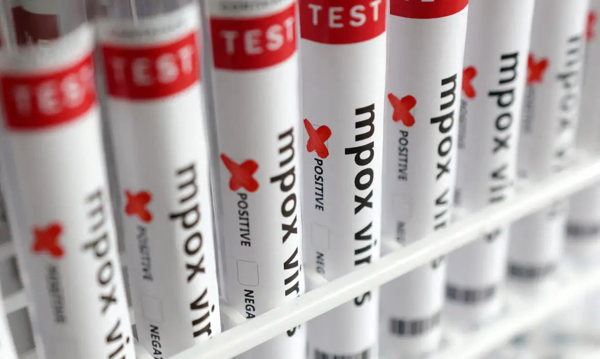 Test tubes labelled